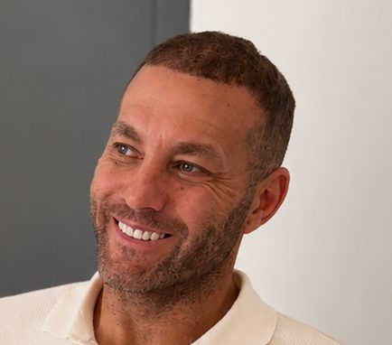 Michael Carter, founder of Hairstoration, after his hair transplant