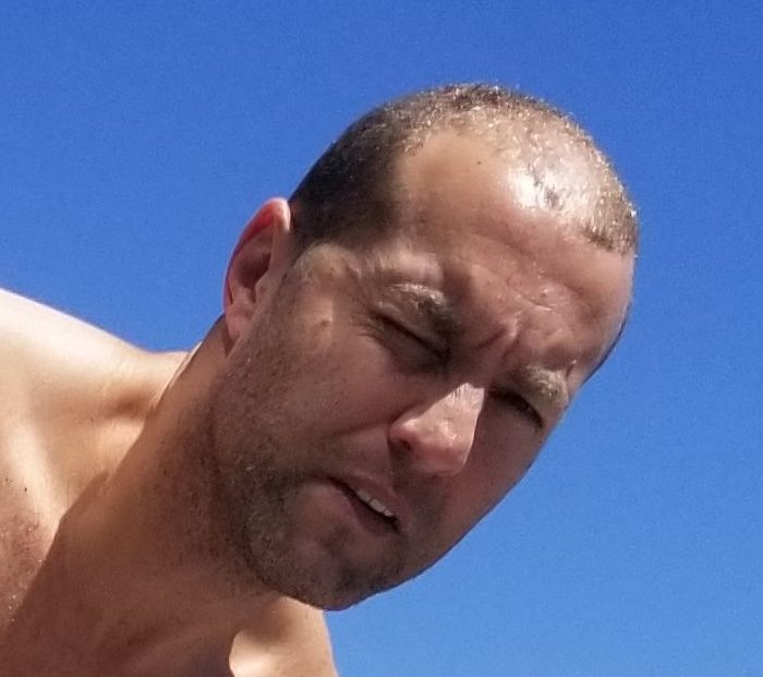 Michael Carter before his hair transplant